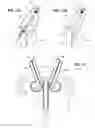 Fig. 10 - Apparatus to orient a pushpin