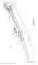 Fig. 03 - Active front deflector