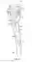 Fig. 05 - Bicycle operating device