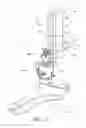Fig. 03 - Bicycle front derailleur