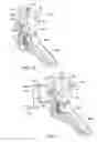 Fig. 12 - Bicycle electrical component