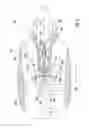 Fig. 03 - Aft engine for an aircraft