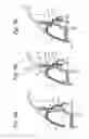 Fig. 06 - LID STRUCTURE FOR CONTAINER