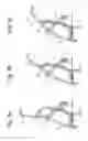 Fig. 07 - LID STRUCTURE FOR CONTAINER