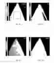 Fig. 10 - Method for functionalizing transition metal dichalcogenides
