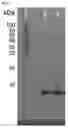 Fig. 02 - Long-acting insulin and use thereof