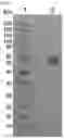 Fig. 05 - Long-acting insulin and use thereof