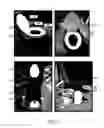 Fig. 05 - Methods and apparatuses for processing human waste into fuel