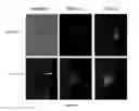 Fig. 16 - Methods for reprogramming cells and uses thereof