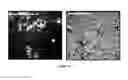 Fig. 19 - Methods for reprogramming cells and uses thereof