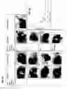 Fig. 06 - METHOD OF MAINTAINING DISEASE STABILITY IN A SUBJECT HAVING GAUCHER'S DISEASE