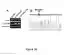 Fig. 17 - Small interfering RNA (siRNA) for the therapy of type 2 (ADO2) autosomal dominant osteopetrosis caused by CLCN7 (ADO2 CLCN7-dependent) gene mutation