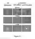Fig. 22 - Small interfering RNA (siRNA) for the therapy of type 2 (ADO2) autosomal dominant osteopetrosis caused by CLCN7 (ADO2 CLCN7-dependent) gene mutation