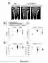 Fig. 25 - Small interfering RNA (siRNA) for the therapy of type 2 (ADO2) autosomal dominant osteopetrosis caused by CLCN7 (ADO2 CLCN7-dependent) gene mutation