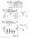 Fig. 27 - Small interfering RNA (siRNA) for the therapy of type 2 (ADO2) autosomal dominant osteopetrosis caused by CLCN7 (ADO2 CLCN7-dependent) gene mutation