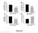 Fig. 30 - Small interfering RNA (siRNA) for the therapy of type 2 (ADO2) autosomal dominant osteopetrosis caused by CLCN7 (ADO2 CLCN7-dependent) gene mutation