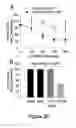 Fig. 31 - Small interfering RNA (siRNA) for the therapy of type 2 (ADO2) autosomal dominant osteopetrosis caused by CLCN7 (ADO2 CLCN7-dependent) gene mutation