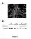 Fig. 02 - Compositions and methods for modulating dysferlin expression