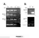Fig. 03 - Compositions and methods for modulating dysferlin expression