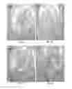 Fig. 29 - POLYNUCLEOTIDES AND POLYPEPTIDES IN PLANTS