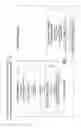 Fig. 13 - Nucleic Acid Amplification With Integrated Multiplex Detection