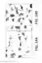 Fig. 17 - In situ detection of nucleotide variants in high noise samples, and compositions and methods related thereto
