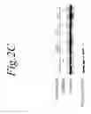 Fig. 12 - NOL3 is a predictor of patient outcome