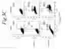 Fig. 16 - NOL3 is a predictor of patient outcome