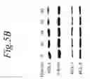 Fig. 24 - NOL3 is a predictor of patient outcome