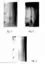 Fig. 03 - Corrosion control coating