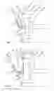 Fig. 03 - Method for preparing a yarn end for spinning-in at a rotor spinning device of a rotor spinning machine along with a rotor spinning machine