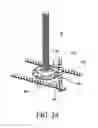 Fig. 18 - Concrete anchor
