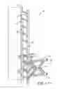 Fig. 04 - Ladder attachment system for a wind turbine