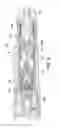 Fig. 05 - Underreamer for increasing a wellbore diameter