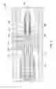 Fig. 06 - Underreamer for increasing a wellbore diameter