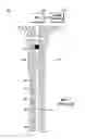 Fig. 02 - Retrievable plugging tool for tubing