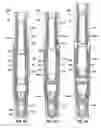 Fig. 06 - Retrievable plugging tool for tubing