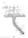 Fig. 02 - Multi chip module housing mounting in MWD, LWD and wireline downhole tool assemblies