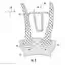 Fig. 04 - LOW MODULUS INSERT FOR A COMPONENT OF A GAS TURBINE ENGINE