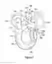Fig. 06 - Multi-stage turbocharger system