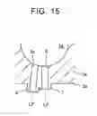 Fig. 11 - Cylinder injection internal combustion engine