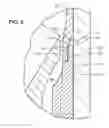 Fig. 05 - Metal-to-metal sealing for diffusers of an electrical submersible well pump