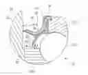 Fig. 01 - Sealing system for a rolling bearing