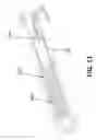 Fig. 12 - Electric actuator