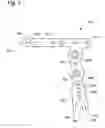 Fig. 06 - DEVICE AND METHOD FOR ADJUSTING BOW SIGHT AT FULL DRAW