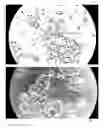 Fig. 04 - METHOD OF OBSERVING MICROORGANISM ACTIVITY IN A HUMAN TISSUE SAMPLE