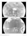 Fig. 05 - METHOD OF OBSERVING MICROORGANISM ACTIVITY IN A HUMAN TISSUE SAMPLE