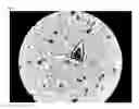 Fig. 08 - METHOD OF OBSERVING MICROORGANISM ACTIVITY IN A HUMAN TISSUE SAMPLE