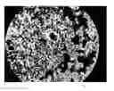 Fig. 09 - METHOD OF OBSERVING MICROORGANISM ACTIVITY IN A HUMAN TISSUE SAMPLE