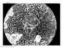 Fig. 10 - METHOD OF OBSERVING MICROORGANISM ACTIVITY IN A HUMAN TISSUE SAMPLE